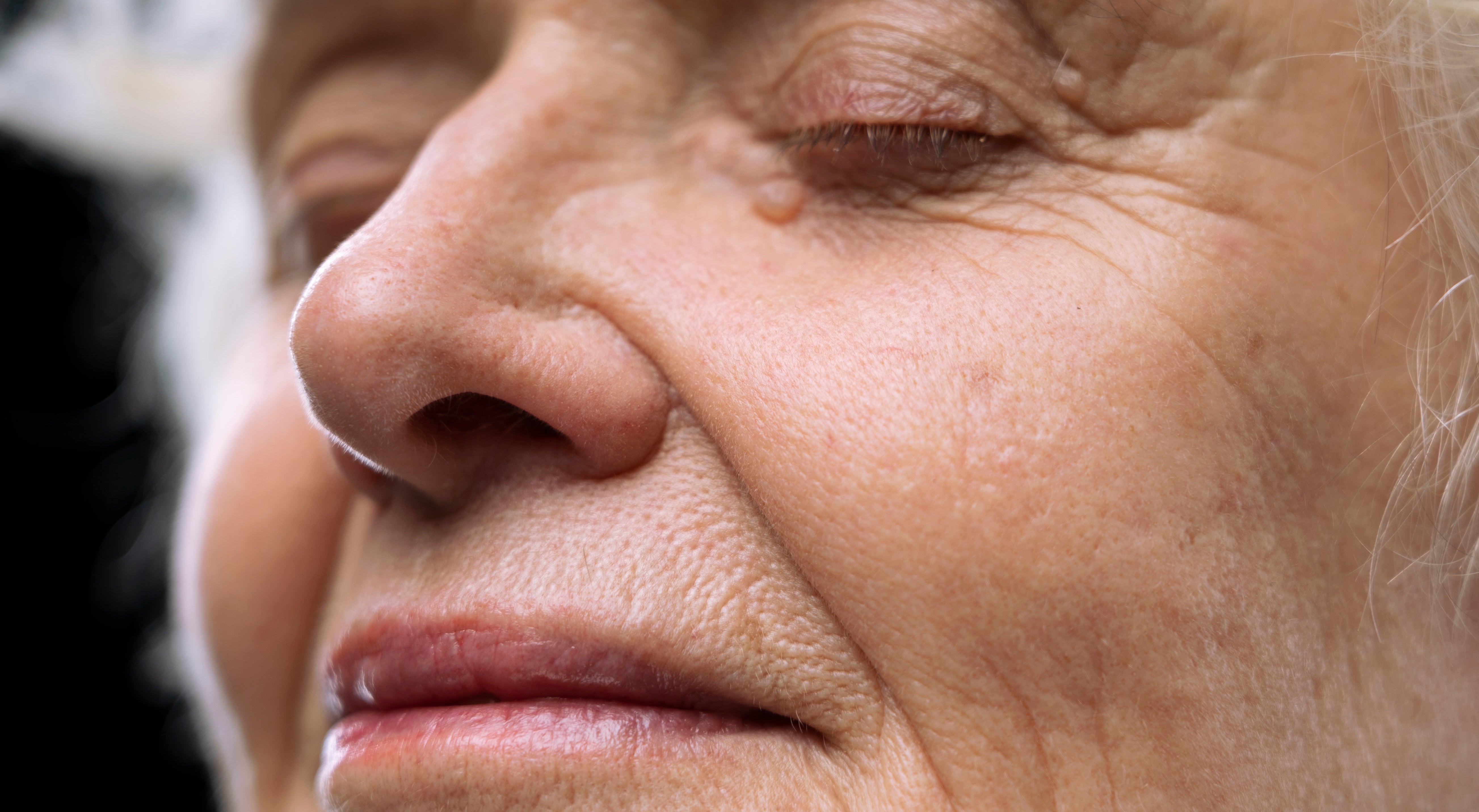 What Causes Skin Ageing? Are There Natural Anti-Ageing Remedies?
